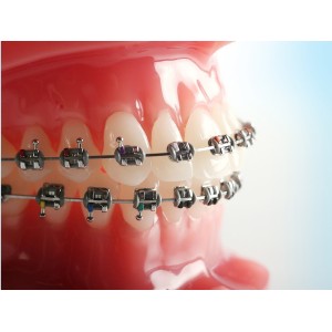 ROTH 022 W/HOOK 3,4,5. KIT BRACKET MINIPREVAIL