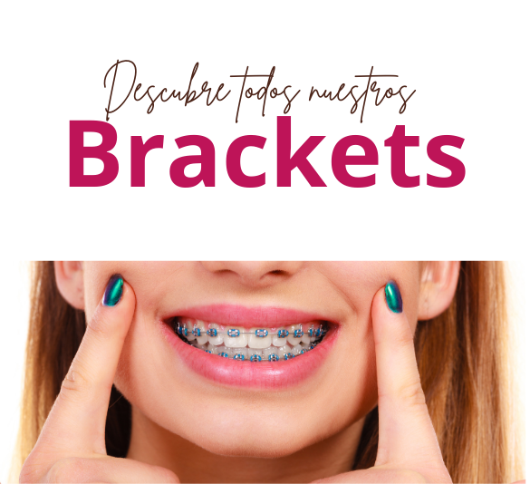 Brackets, descubrelos todos